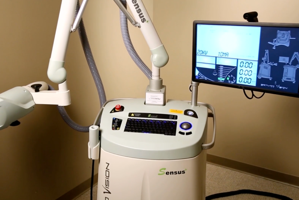 SRT Technology from Sensus Healthcare offers non-invasive skin cancer treatment options